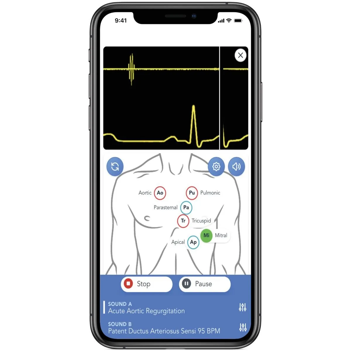 SAM4 Plus Auscultation Manikin, Light